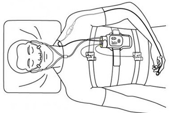Sleep Study