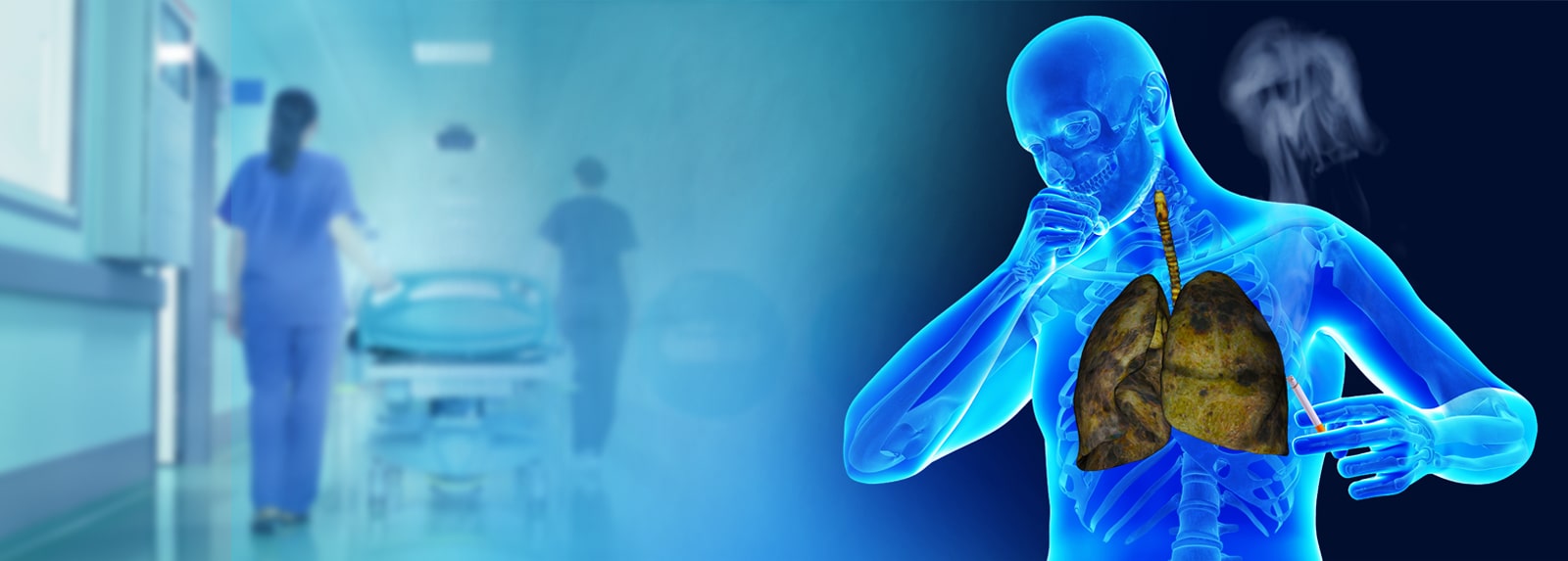 THORACOSCOPY PROCEDURE