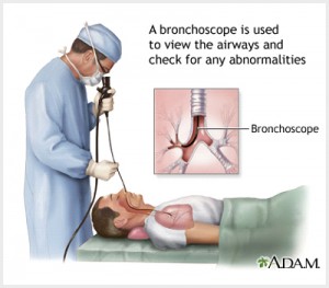 bronchoscopy
