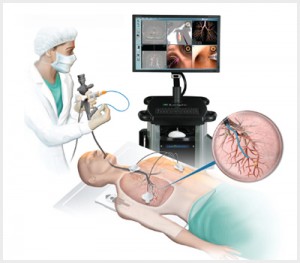bronchoscopy