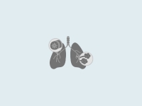 COPD
