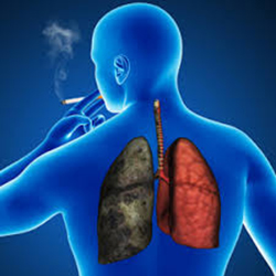 COPD