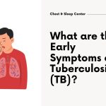 What are the Early Symptoms of Tuberculosis (TB)