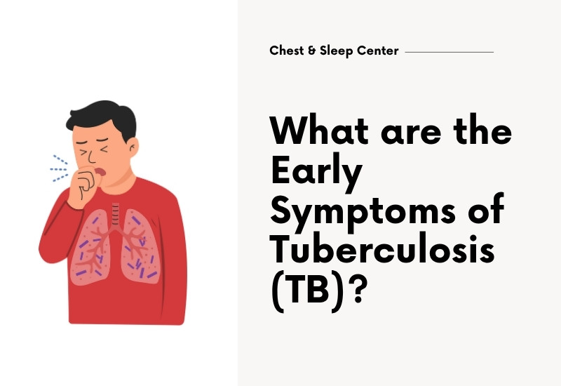 What are the Early Symptoms of Tuberculosis (TB)